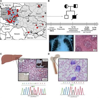 Infant with diffuse large B-cell lymphoma identified postmortem with homozygous founder Slavic RAG1 variant: a case report and literature review